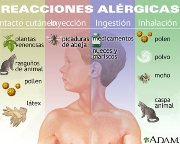 D A Internacional De Las Alergias Cu Les Son Las Principales Y Las M S