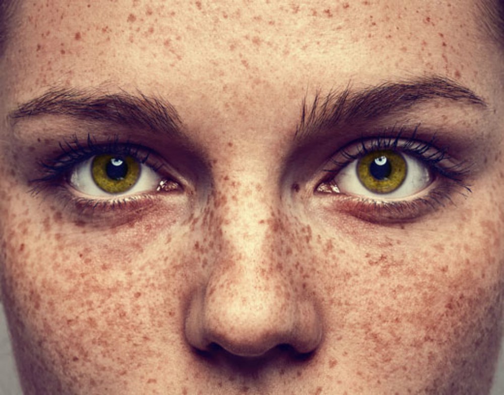 Manchas cutáneas: Síntomas y causas