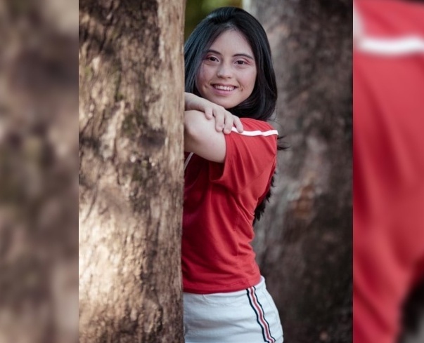 Tiene síndrome de Down y sueña con ser modelo