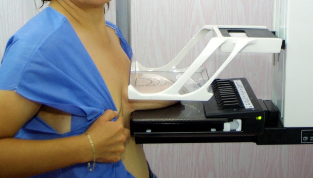 “La revisión de las mamas debe formar parte del exámen ginecológico”