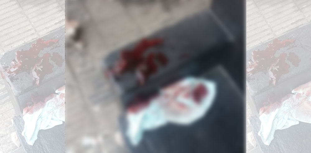 “Corrientes” lucha por un milagro aferrado al respirador artificial
