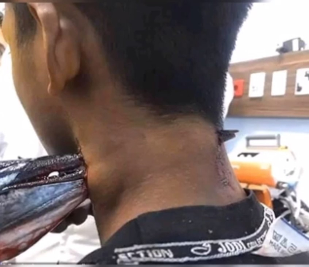 “Saltó del agua y me apuñaló en el cuello”