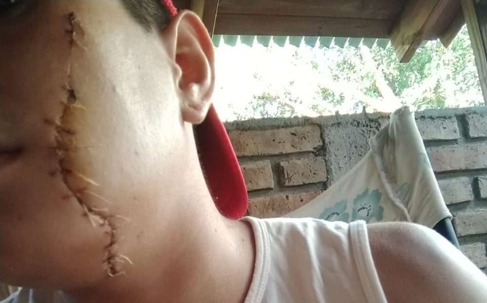 CICATRIZ. El joven que fue agredido en un paseo público de Cerro Azul.