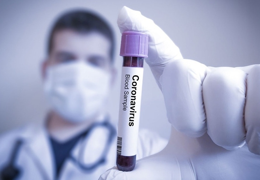 Coronavirus: se registró la cuarta muerte en Argentina