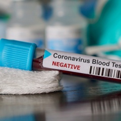 negativo - coronavirus Covid-19