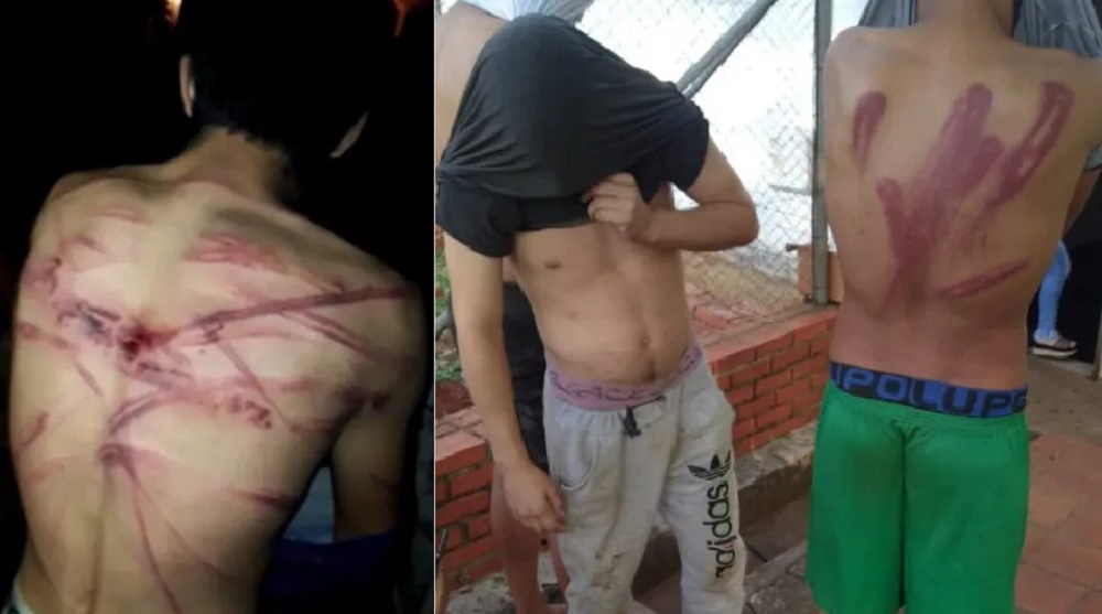 Escándalo en Paraguay por brutal golpiza a más de treinta detenidos