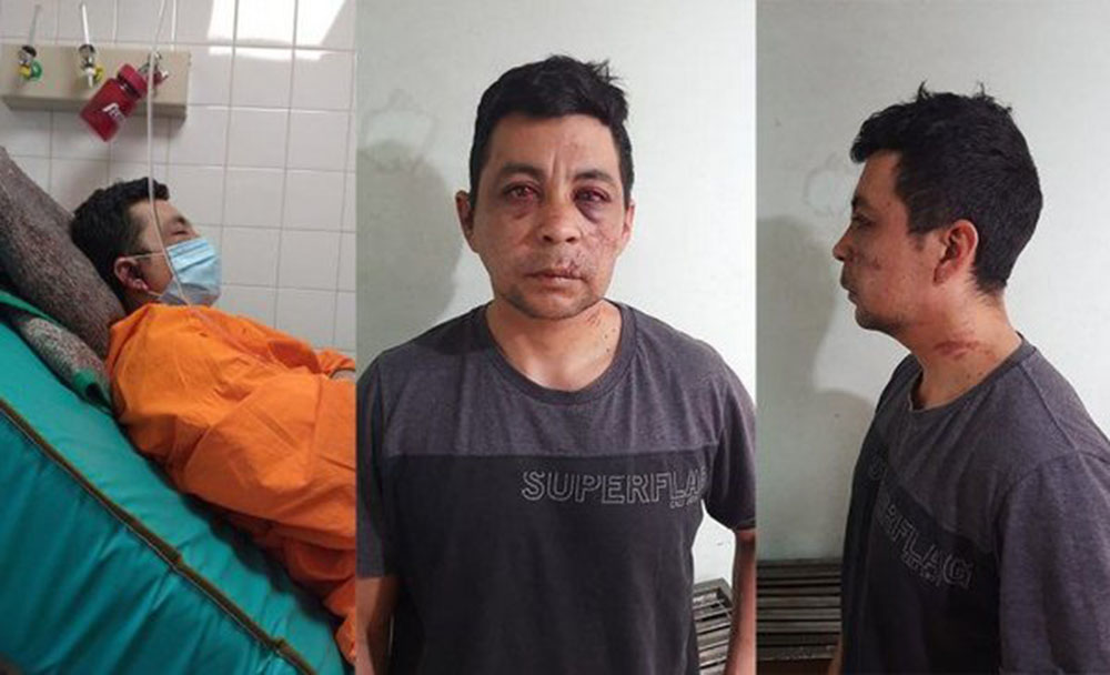 Tuvo COVID-19 y lo lincharon los vecinos