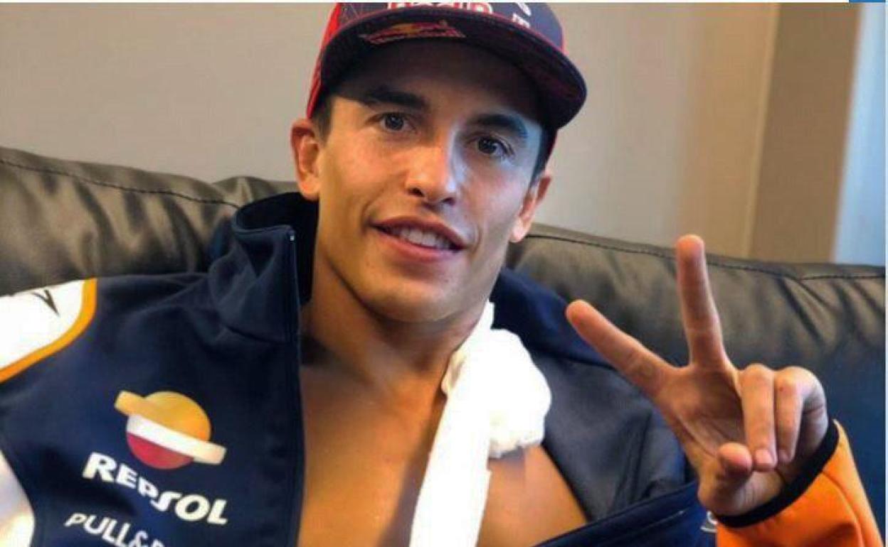 MotoGP: tras la lesión, Márquez apunta a volver en agosto en República Checa