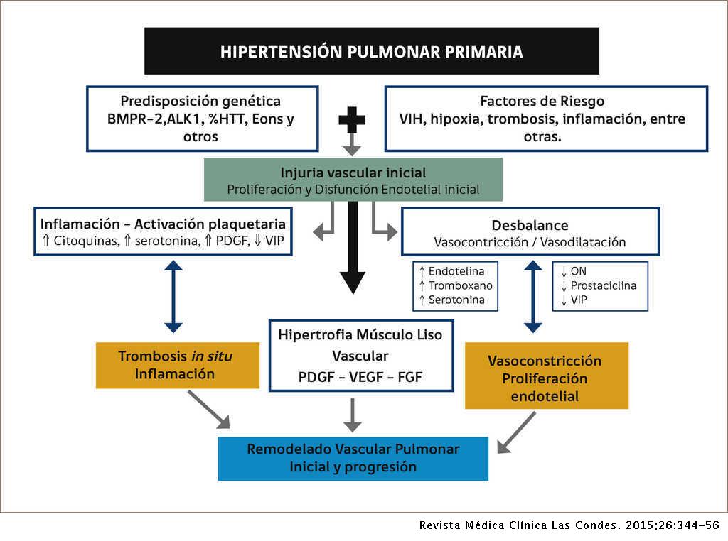 Hipertensión pulmonar qué es y cómo diagnosticarla Primera Edición