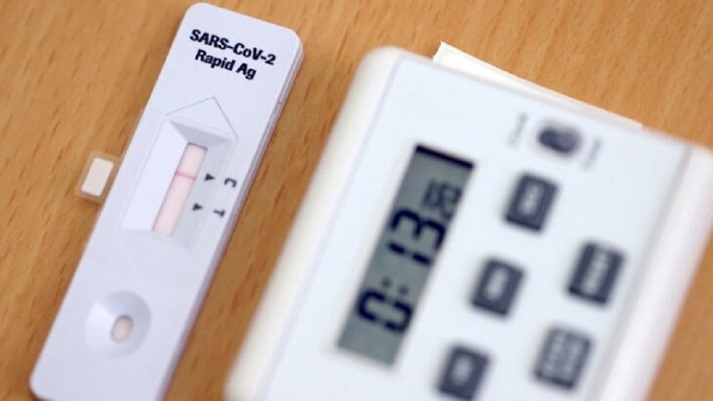 Test rápidos coronavirus