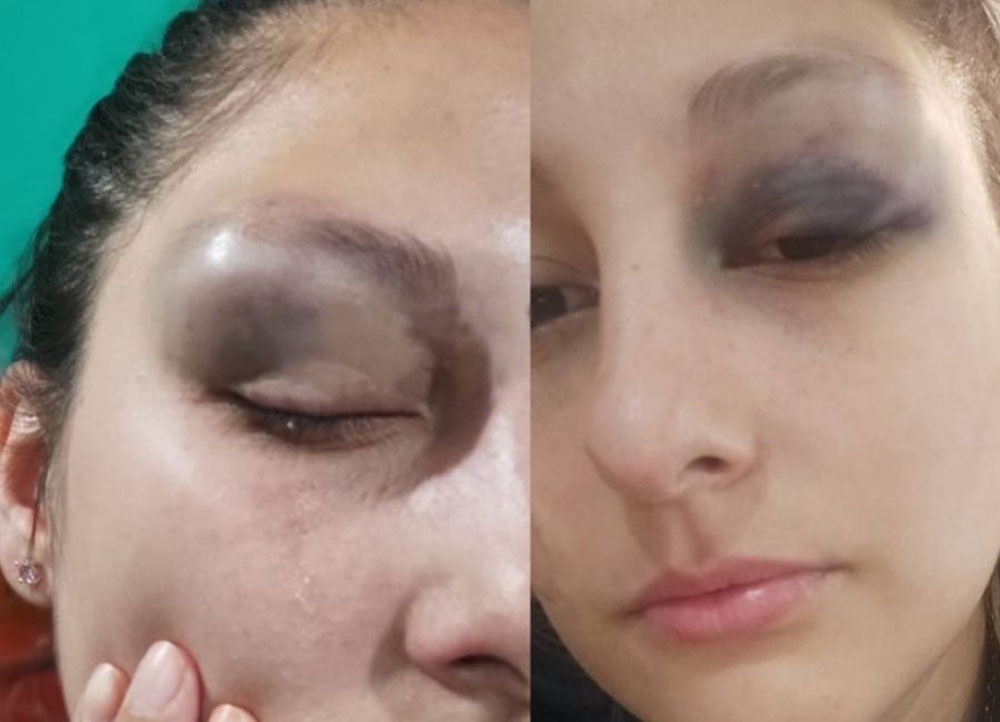 Una Policía fue agredida tras intervenir en un caso de violencia de género