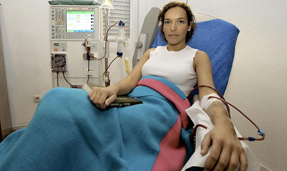 En Misiones hay 700 pacientes con insuficiencia renal en diálisis