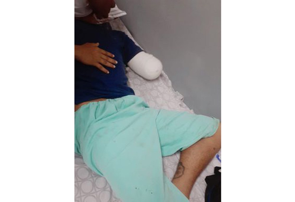 Salió a tomar algo y regresó sin un brazo