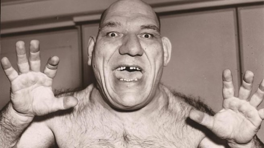 Qué es la acromegalia, una condición que puede tardar cinco años en diagnosticarse