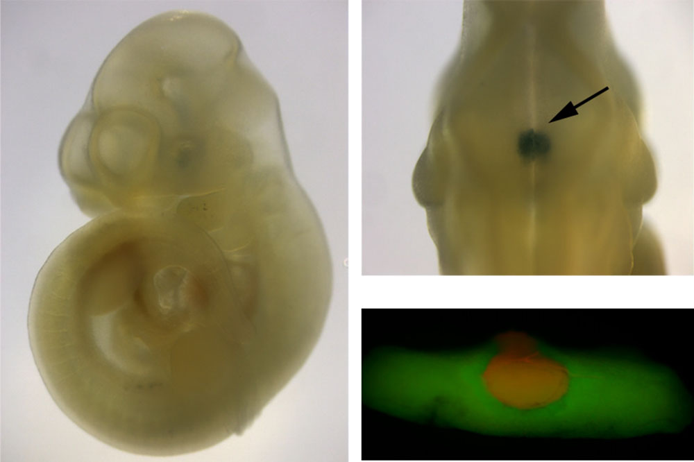 Investigan el origen del hipopituitarismo congénito en niños