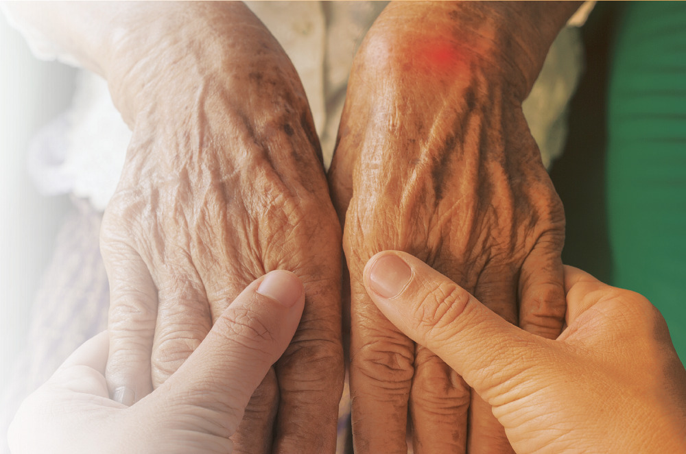 Artritis Reumatoide: la importancia de identificarla y tratarla a tiempo