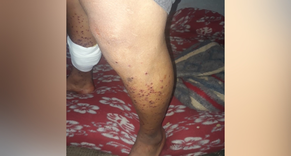 El disparo al interno en la prisión de Loreto no habría sido de estruendo