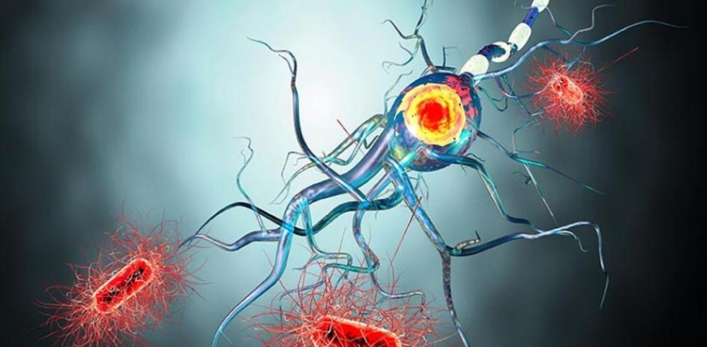 Esclerosis múltiple: virus de la enfermedad del beso sería la causa principal