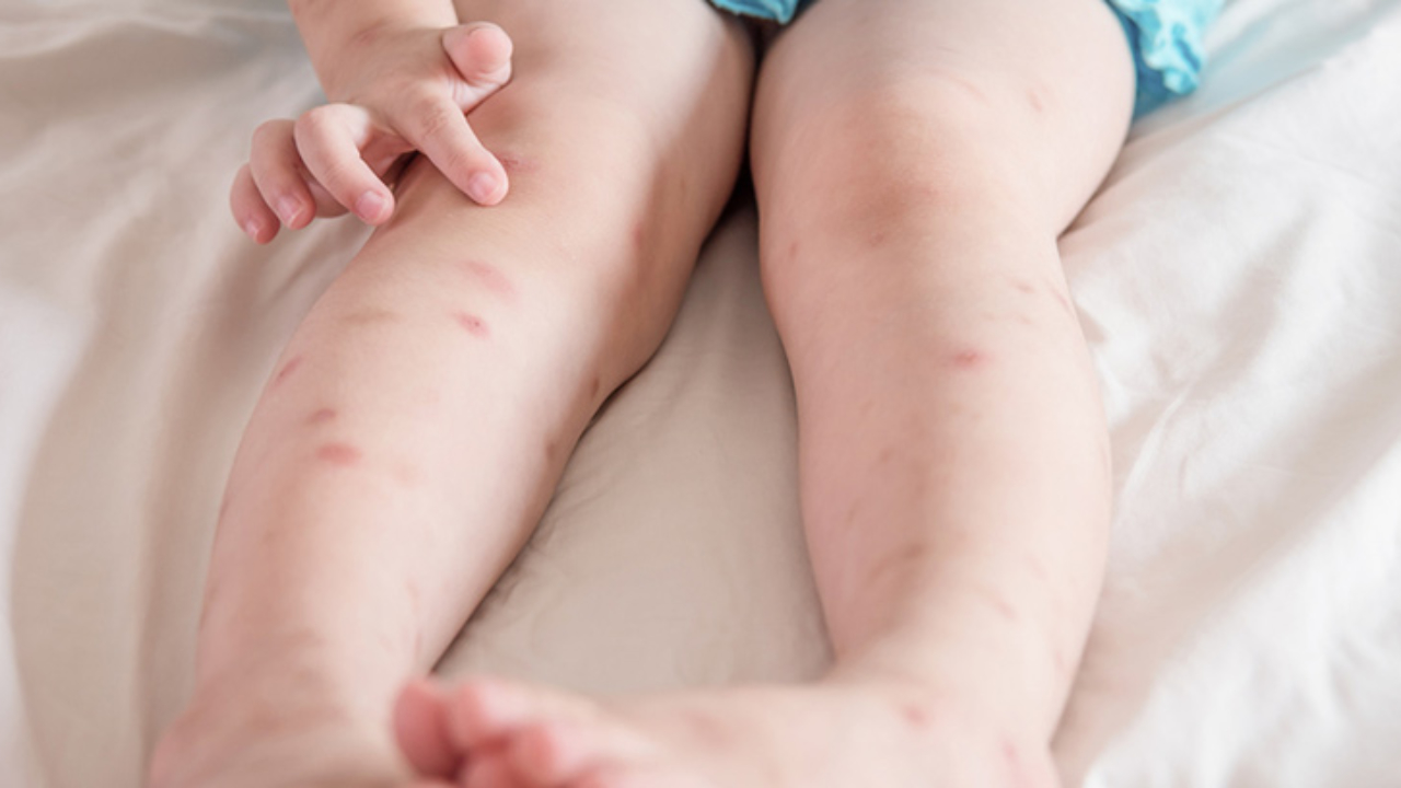 Hubo cinco casos de leishmaniasis en los últimos dos años