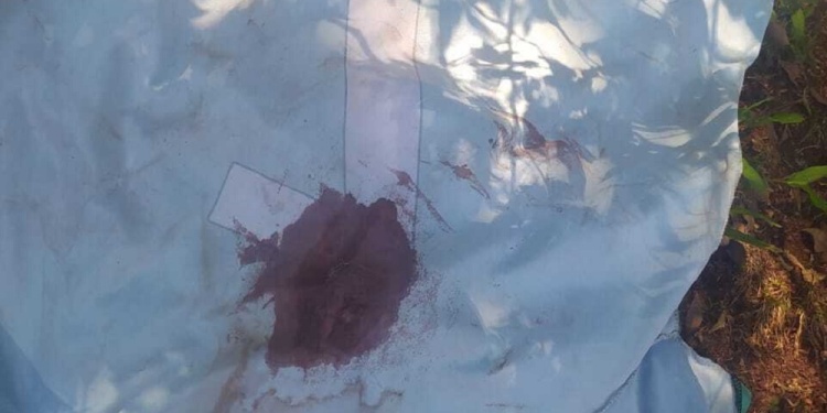 LESIÓN. El proyectil ingresó por la espalda y salió por el hombro del menor.