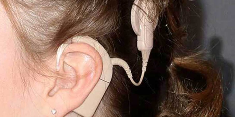MPLANTES COCLEARES. Gracias a ellos, Génesis de ocho años podía escuchar de ambos lados.