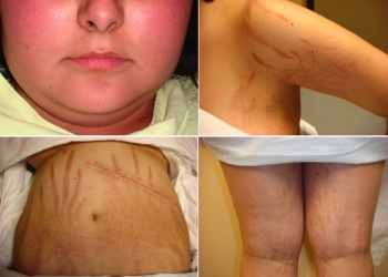 Efemérides 8 de abril: Qué se celebra hoy