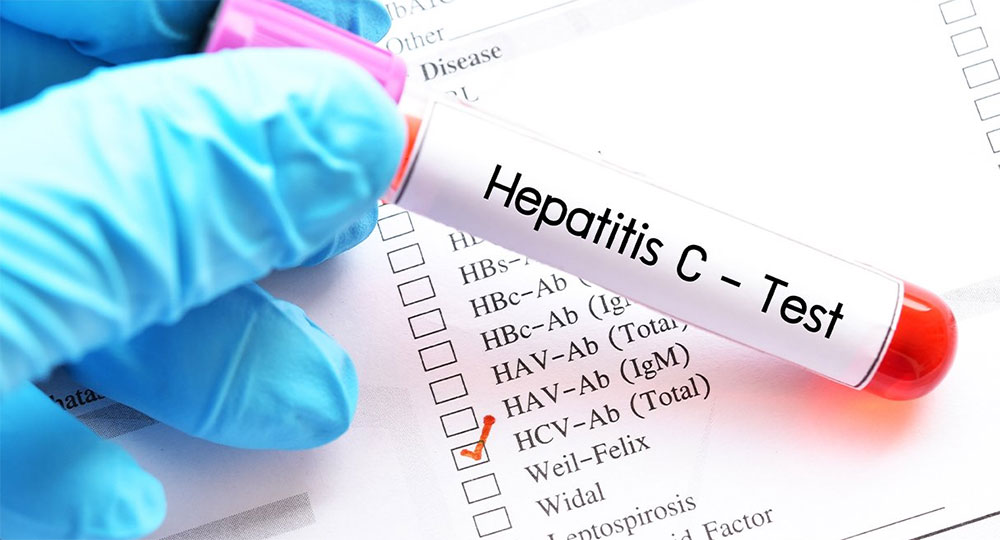 “La hepatitis B es una enfermedad inmunoprevenible”