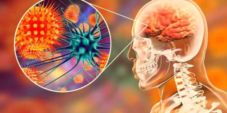 (Imagen: El Universal)