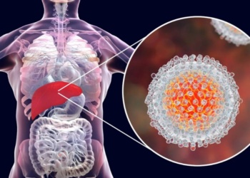 Detectaron el primer caso argentino de hepatitis aguda grave de origen desconocido