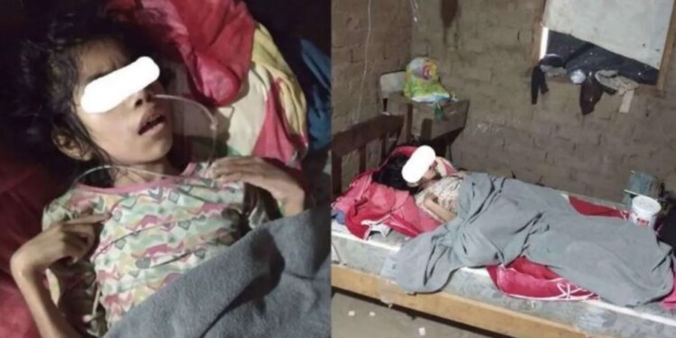 La niña estaba postrada en su cama sumida en una profunda depresión, ciega y sin decir ni una palabra.
/Foto: Qué pasa Salta