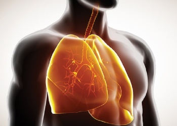 Qué es la Hipertensión Arterial Pulmonar y cómo afecta