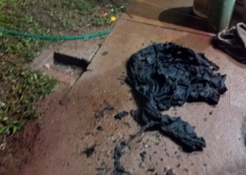 Discutió con su pareja, se prendió fuego y está grave