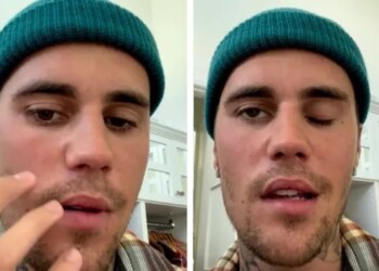 Justin Bieber suspende su gira por una parálisis facial