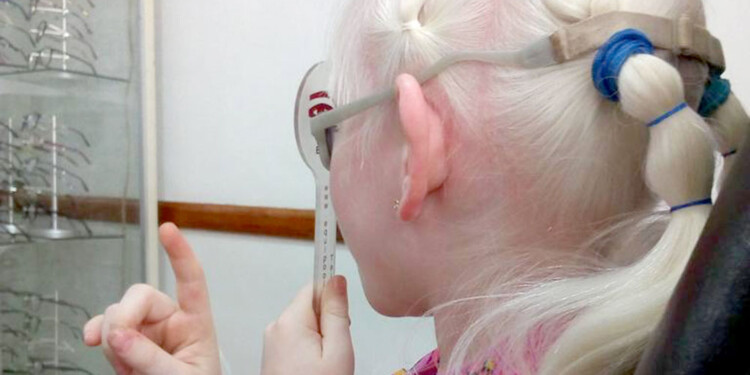 RESPUESTA. Una de las principales necesidades sanitarias es el acceso a lentes con graduaciones especiales.