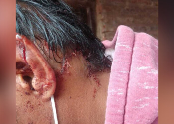 Salieron a comprar cigarrillos y los apuñalaron y machetearon