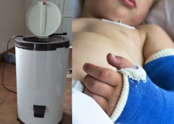 Accidentes domésticos: alertan sobre lesiones infantiles por secarropas