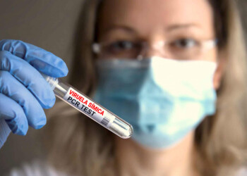 Confirman el tercer caso de viruela del mono en Argentina, el primero sin antecedentes de viaje