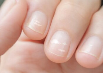 Prestar atención a las uñas puede salvar la vida