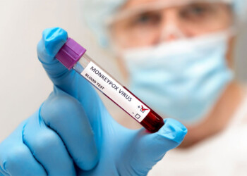 La OMS activó su máximo nivel de alerta sanitaria por la viruela del mono