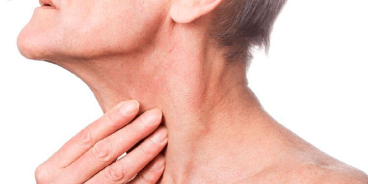 CONSULTAR. Indicaron consultar ante la aparición de ganglios inflamados en el cuello y lesiones bucales que no curan luego de 15 días.