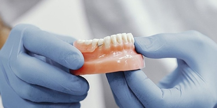 PRÓTESIS. Como cada vez menos odontólogos trabajan con obras sociales cada vez son más las personas que dejan de lado sus tratamientos.