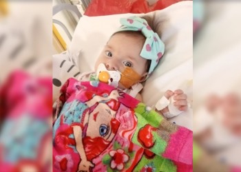 Con sólo cinco meses de edad, Emma necesitará un trasplante de corazón