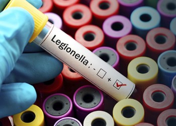 Advierten que la bacteria Legionella suele alojarse en lugares húmedos