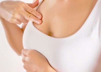 “Más del 75% de las mujeres con cáncer de  mama no tienen antecedentes familiares”