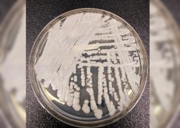 Detectaron en el país dos casos del peligroso Candida auris