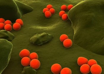 Día de la Mielofibrosis: una enfermedad silenciosa, veloz y que afecta cada vez a más jóvenes