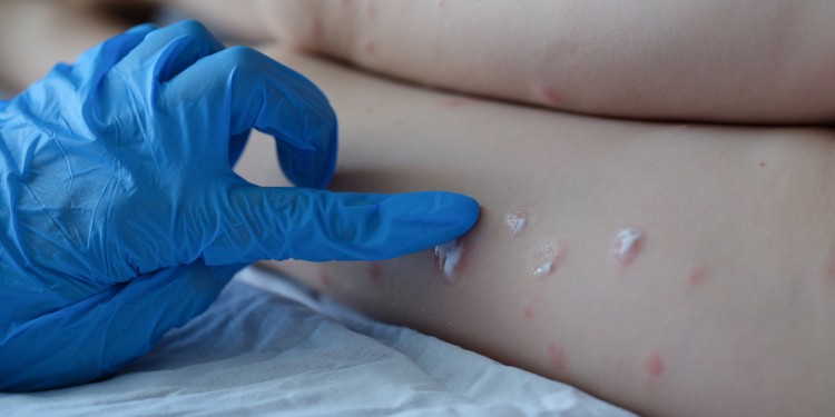 (Imagen ilustrativa)