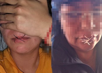 Detenidas en la UP-V se cosieron la boca, reclaman respuestas a la Justicia provincial