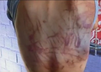 Una menor de edad fue víctima de abuso, golpes e intento de femicidio