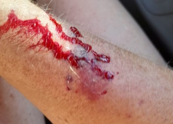 Rescatista de animales fue atacada por un perro en Eldorado